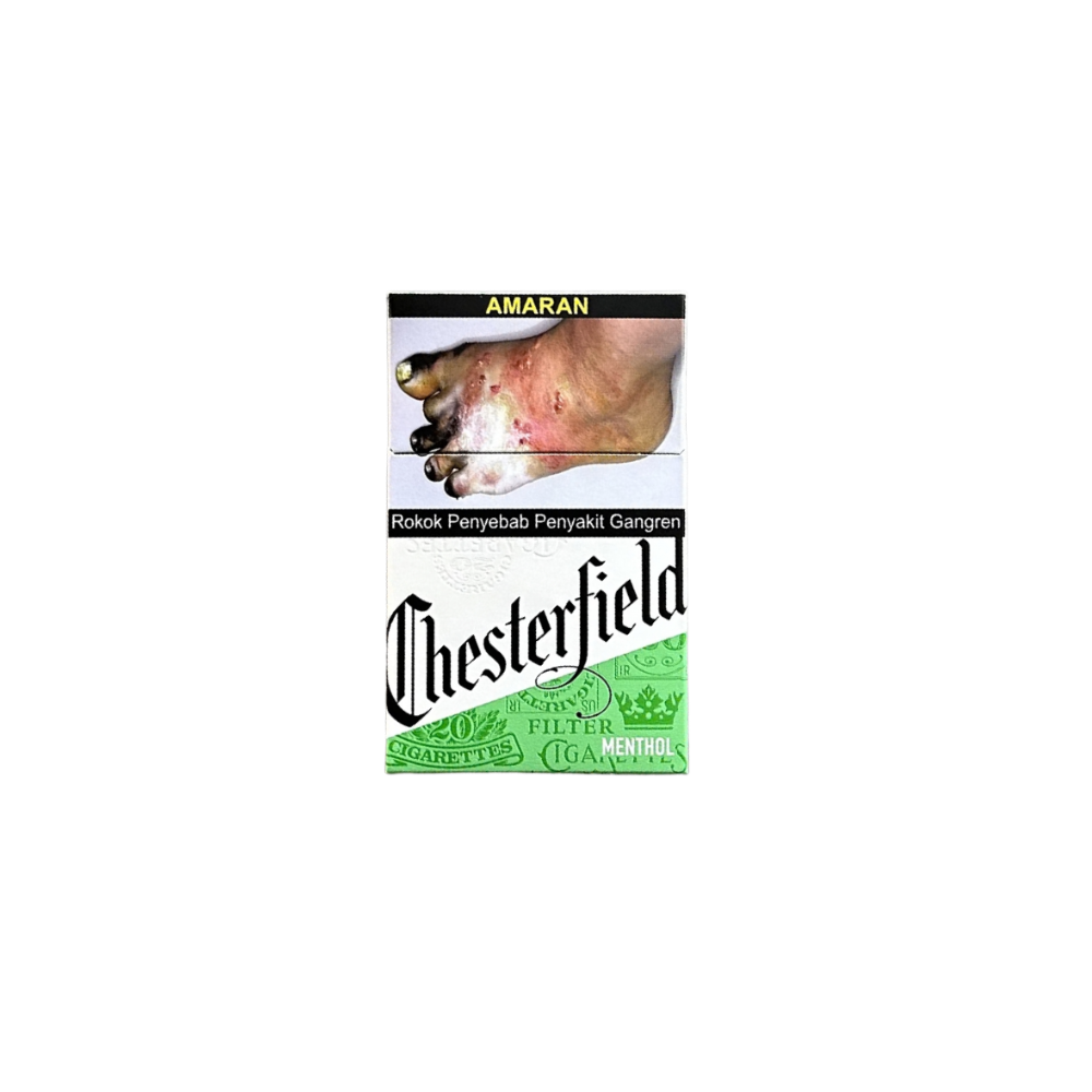 Chesterfield - Image 3